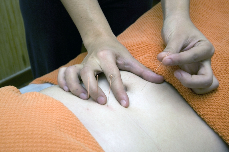 osteopathe-FLASSANS SUR ISSOLE-min_acupuncture-4175625